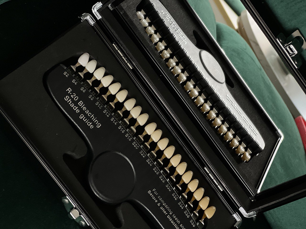 Professionelle Zahnaufhellung und Bleaching in Frankfurt